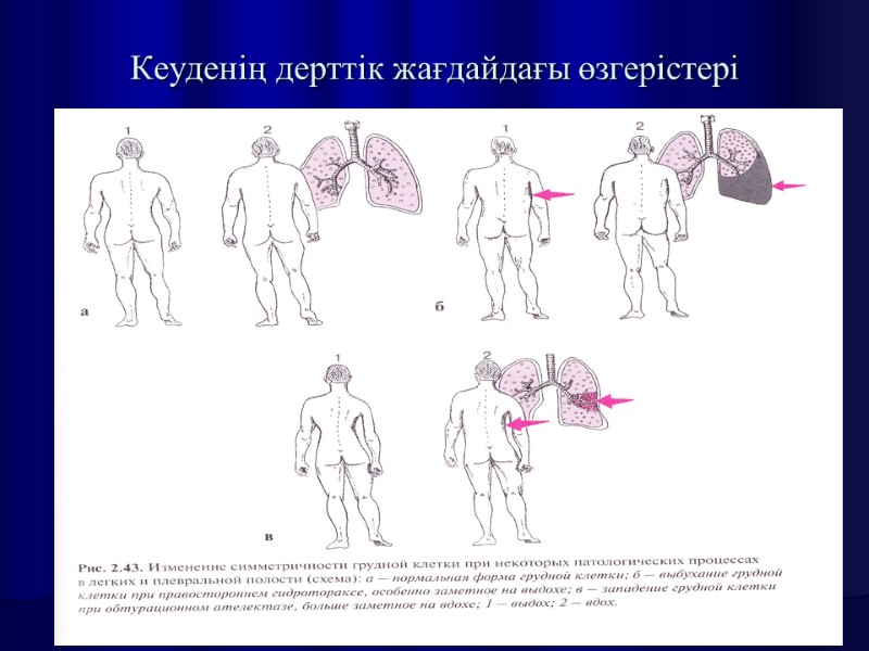 Кеуденің дерттік жағдайдағы өзгерістері